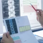 Bone Density test