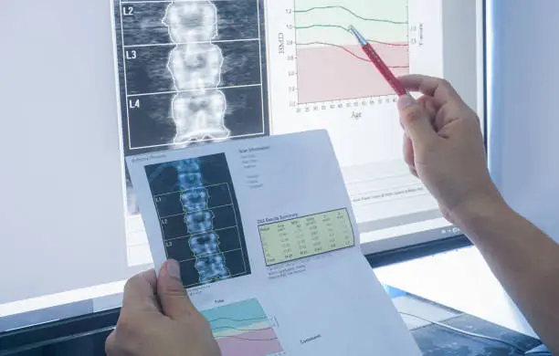 Bone Density test